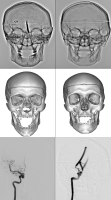 INR_Fig_2_ Skull